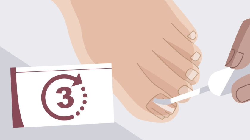 Nailner美甲修復(fù)劑真菌指甲治療藥品TVC二維動畫廣告策劃“7天見效”